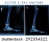 12,856 Leg Xray Royalty-Free Images, Stock Photos & Pictures | Shutterstock