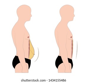 Vector of abdominal male anatomy with fat