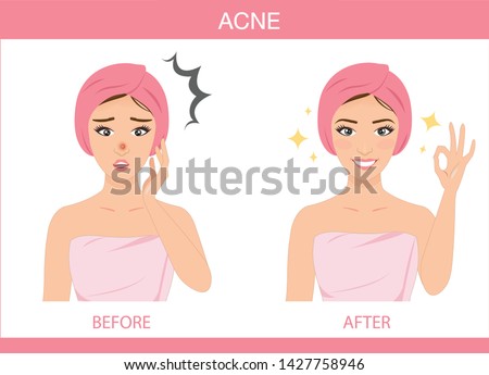 Vector of Acne problem on woman face