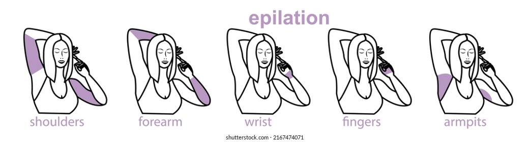 zonas de epilación del brazo vectorial, depilación láser, procedimiento de eliminación del folículo capilar de las mujeres, pelo oscuro, pelos de los brazos en los axilos y en los brazos