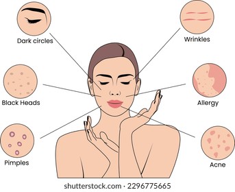 Vector Art Depicting Various Skin Issues, Vector-Based Guide to Skin Problems, Illustrated Vector Guide to Skin Conditions