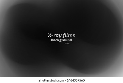 Vector background illustration X-ray film concept 