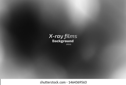 Vector background illustration X-ray film concept 
