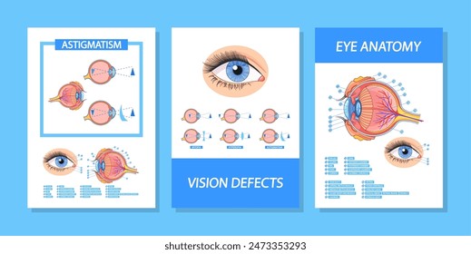 Anuncios De Vector Con Una Infografía Detallada Que Explique La Anatomía Del Ojo, Los Defectos Visuales Y El Astigmatismo