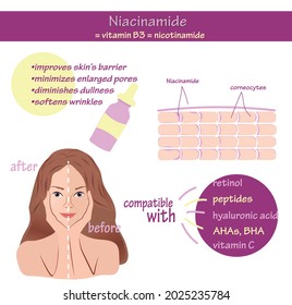 Vector beauty infographic with anatomical scheme explained beneficial Niacinamide B3 effect on skin problems to improve texture acne ageing tone. Healthy skin care girl young face before after compare