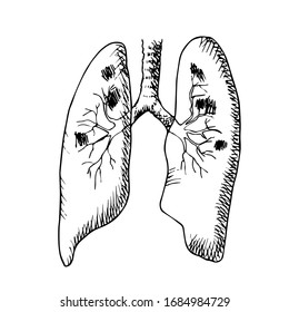 Vector Black And White Illustration Of A Lung Affected By A Disease. Human Lungs. Hand Drawn