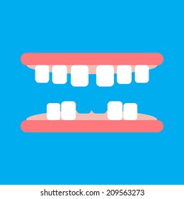 Vector Of Broken Tooth Model On Blue Background. Cartoon Illustration. 