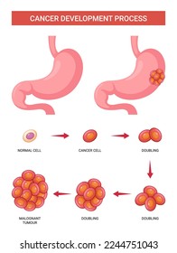 Vector cancer development process infographic