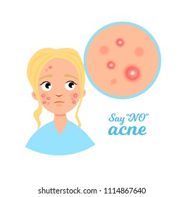 1,730 Skin rash cartoon Images, Stock Photos & Vectors | Shutterstock