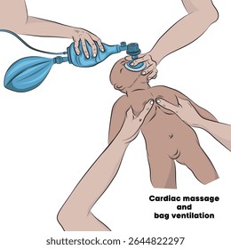 Massagem cardíaca em bebês.