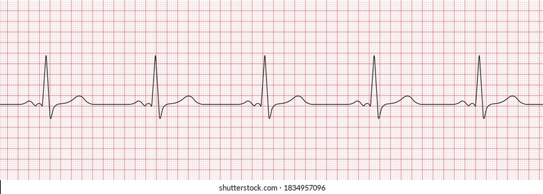 Vector cardiogram or pulse on a dark background. heartbeat electrocardiogram. Vector illustration