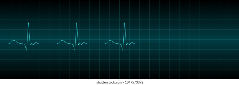 Vector cardiogram or pulse on a dark background. heartbeat electrocardiogram. Vector illustration