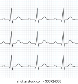 Vector cardiogram,flat design