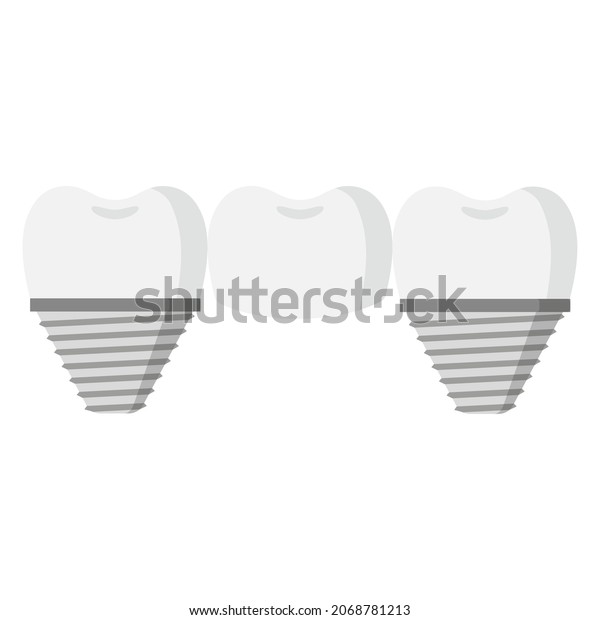 Vector Cartoon Dental Bridge Teeth Dental Stock Vector (Royalty Free