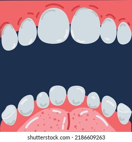 Vector cartoon illustration of human teeth, open mouth, inside view over dark backround