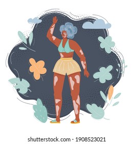 Vector cartoon illustration of young happy woman with vitiligo skin, pigmentation on arms and legs wearing swimsuit on dark background.