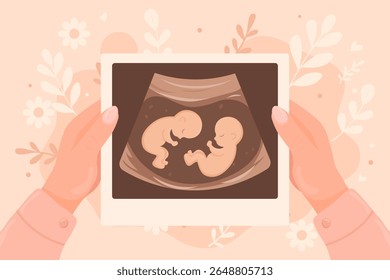 Vector cartoon image of pregnancy confirmation in girl's hands. Desired pregnancy. Ultrasound image. Concept of motherhood and children. Element for your design