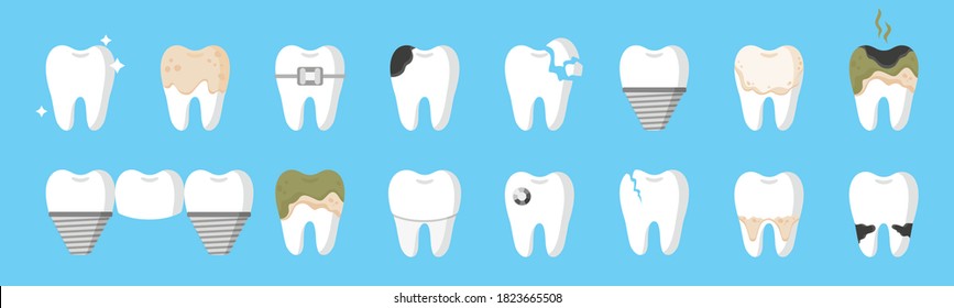 Vector cartoon set of teeth with different types of dental diseases: caries, tartar, plaque, implant, dental bridge, orthodontic braces etc. Dental concept.