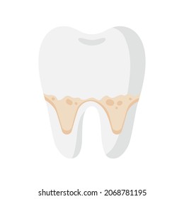 Vector cartoon tooth with dental root plaque and tartar disease. Dental concept.