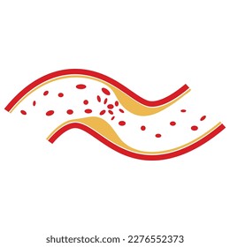 vector de diseño ilustrativo de placa de colesterol