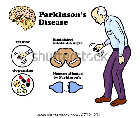 Image result for royalty free images of people with Parkinson's disease