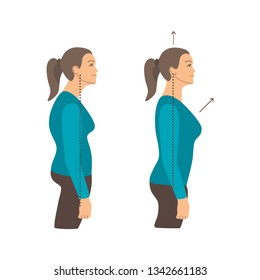 Vector colorful illustration. Neck exercises by girl for relax. Work with back. Uncorrect and correct straight posture. Creative concept. Blue and grey colors. White background