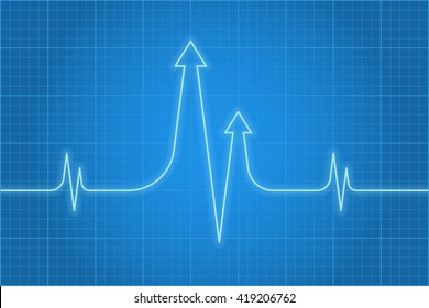 Vector Concept Illustration Of Business Heart Pulse. Light Glossy Beat Line With Arrows On The Dark Blue Background. Infographic Design Element For Web, Internet, Print, Presentation, Social Networks.