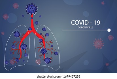 Coronavirus-Krankheit COVID-19 Infektion medizinische Illustration.pathogen respiratory Influenza covid-Viruszellen. Neuer offizieller Name für die Coronavirus-Krankheit COVID-19