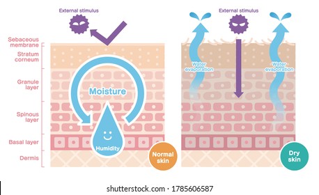 Vector of cross section comparing normal skin and dry skin