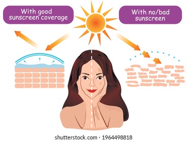 Vector dermatology infographic explained sun impact on skin cells. Compare difference with sunscreen without sunblock. Girl women pigmentation tanned face skin. Protective solar UV UA rays reflection