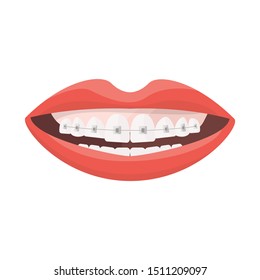 Vector design of mouth and teeth symbol. Graphic of mouth and braces stock vector illustration.