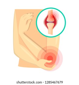 Vector design of pain and disease sign. Set of pain and injury vector icon for stock.