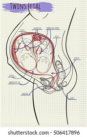 vector diagram amniotik sack twins