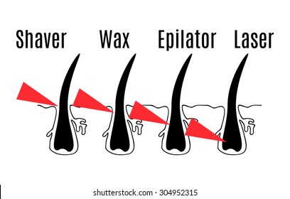 Vector diagram of different methods of hair removal