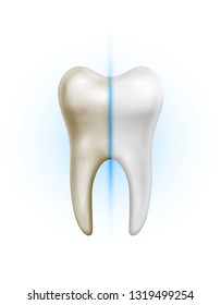Vector dirty tooth and white clean healthy tooth comparison on white background