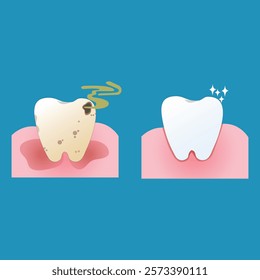 vector of dirty yellow teeth with holes and smells and white teeth, suitable for campaigns to maintain dental hygiene in children