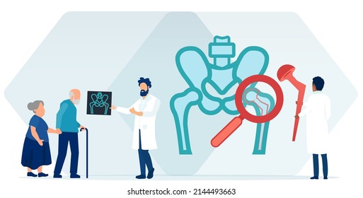 Vector de un médico explicando a ancianos hombres y mujeres un procedimiento de reemplazo de cadera 
