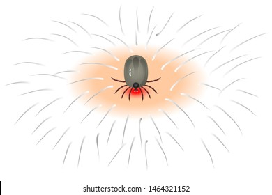 Vector dog tick on a white background Bite the pet Is an insect species The life cycle of an egg is an embryo for an adult teenager.