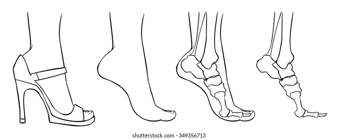 Vector doodle foot on heels, on tiptoes, x-ray, bones