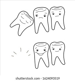 Vector doodle outline illustration with teeth. Black and white cartoon picture in hand-drawn style Isolated on white backdrop. Linear image with Impacted wisdom tooth, third molar. Dental extraction