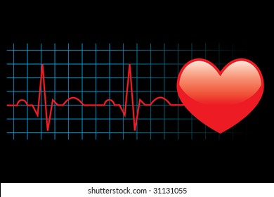 Vector Electrocardiogram