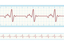 Vector Electrocardiography / ECG On The Powder Blue Grid Paper, Eps10