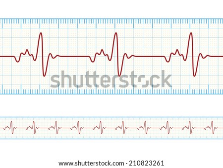 Vector electrocardiography / ECG on the Powder Blue grid paper, eps10