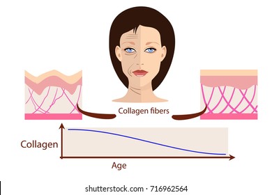 Vector face and two types of skin - aged and young for medical and cosmetological illustrations