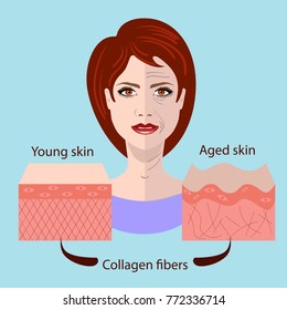 Vector face and two types of skin - aged and young for medical and cosmetological pics