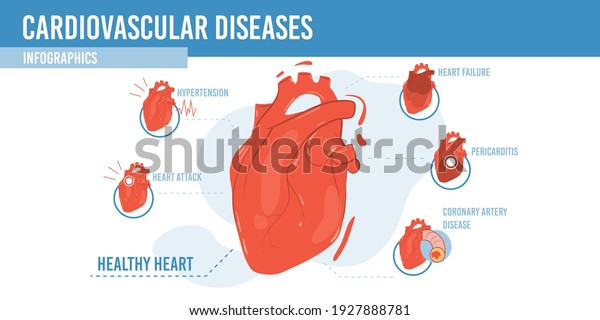 Vector Flat Cartoon Infographichealthy Heart List Stock Vector (Royalty ...