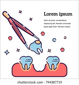 Vector flat illustration on white background in cartoon style. Extraction of tooth with caries. Teeth in the gum,