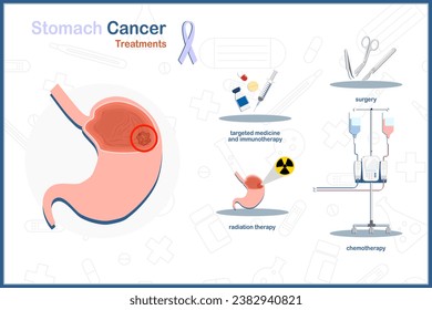 Vector flat medical illustration on stomach cancer concept. Stomach cancer treatment.surgery,chemotherapy,radiation. therapy, targeted therapy and immunotherapy.