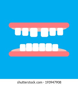 Vector of gap between teeth or diastema. Cartoon illustration.