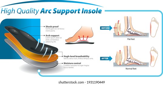 Vector graphic design for three-layered shoe arch support insole -  infographic template.